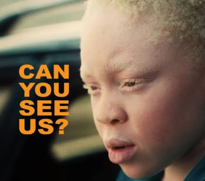 CAN YOU SEEE US reveals more than expected